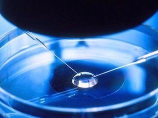 2026年想去芒市做试管婴儿需要准备哪些事？详细收费明细一览