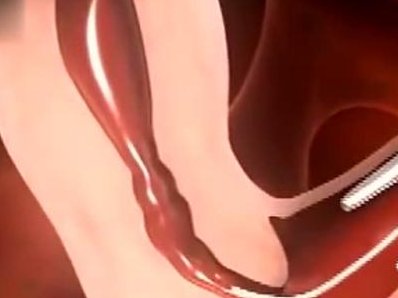 高龄一定要做三代试管吗(第三代试管婴儿技术成熟吗)