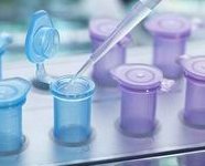 北京试管婴儿技术虽先进，但潜在弊端需谨慎考虑