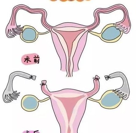 四川哪个公立生殖医院做三代试管婴儿成功率高？